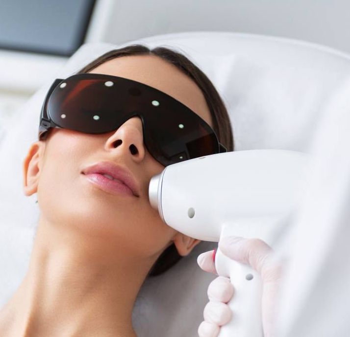 Depilación Facial